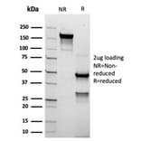 SDS-PAGE - Anti-TROP2 Antibody [rTACSTD2/6395] (A277899) - Antibodies.com
