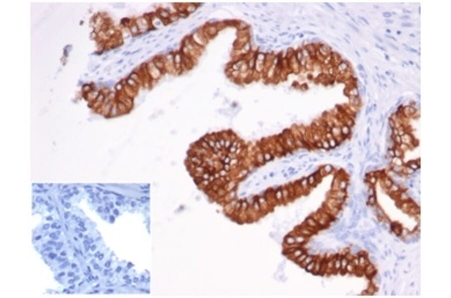 Immunohistochemistry - Anti-EpCAM Antibody [rEGP40/826] (A277900) - Antibodies.com