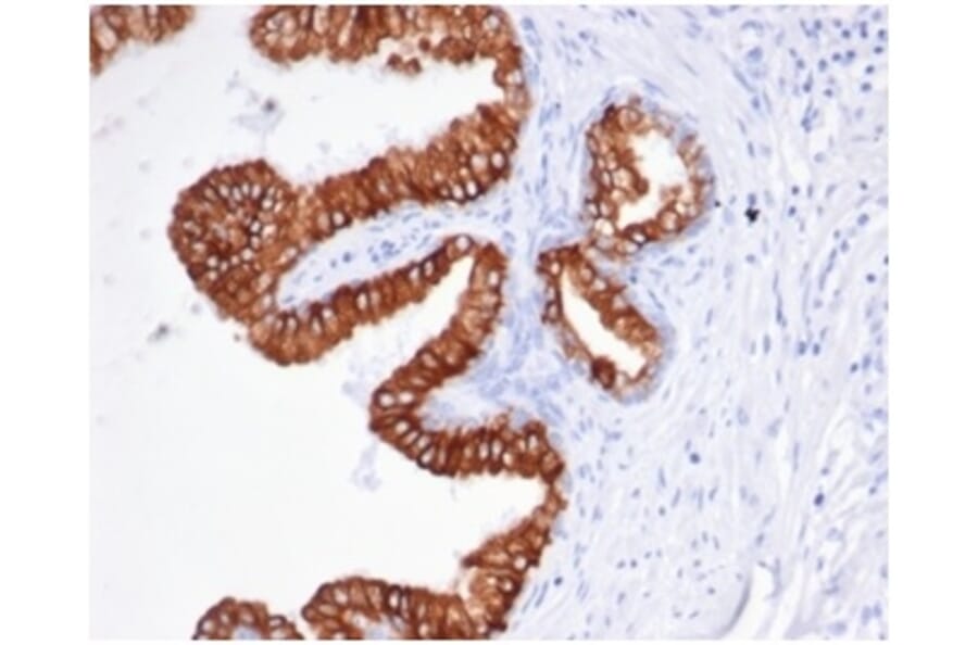 Immunohistochemistry - Anti-EpCAM Antibody [rEGP40/826] (A277900) - Antibodies.com