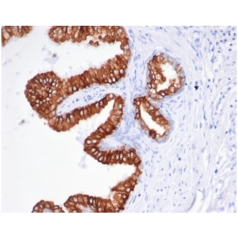 Immunohistochemistry - Anti-EpCAM Antibody [rEGP40/826] (A277900) - Antibodies.com