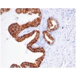 Immunohistochemistry - Anti-EpCAM Antibody [rEGP40/826] (A277900) - Antibodies.com
