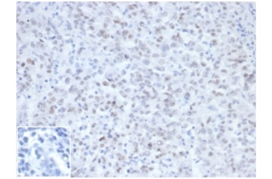 Immunohistochemistry - Anti-MLH1 Antibody [MLH1/6467] (A277901) - Antibodies.com