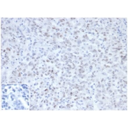 Immunohistochemistry - Anti-MLH1 Antibody [MLH1/6467] (A277901) - Antibodies.com