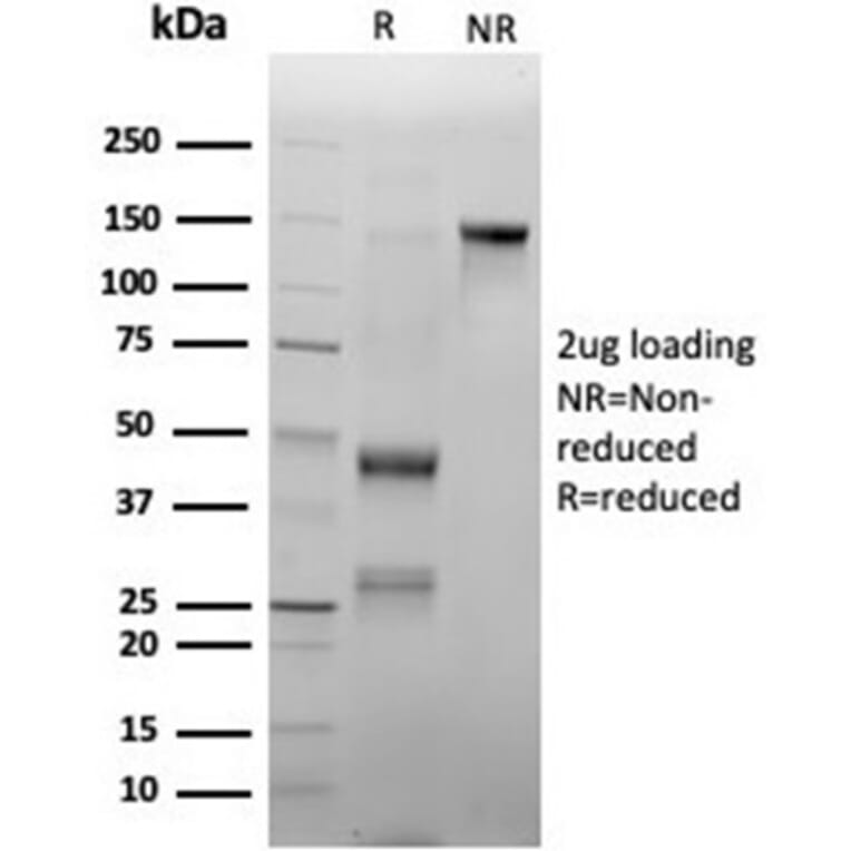 SDS-PAGE - Anti-Myeloperoxidase Antibody [rMPO/6904] (A277902) - Antibodies.com