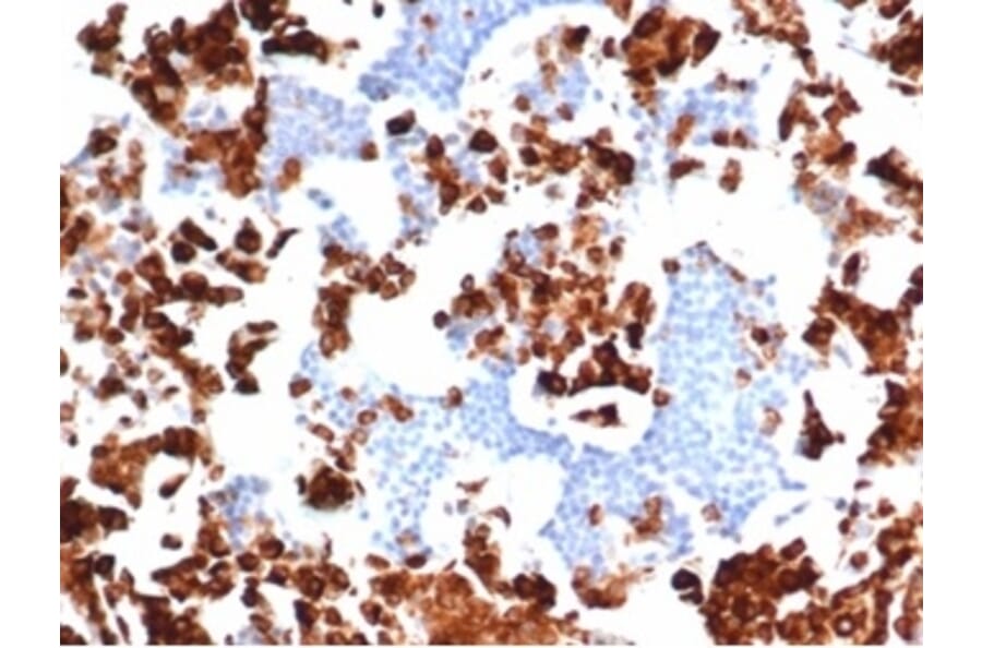Immunohistochemistry - Anti-Myeloperoxidase Antibody [rMPO/6904] (A277902) - Antibodies.com