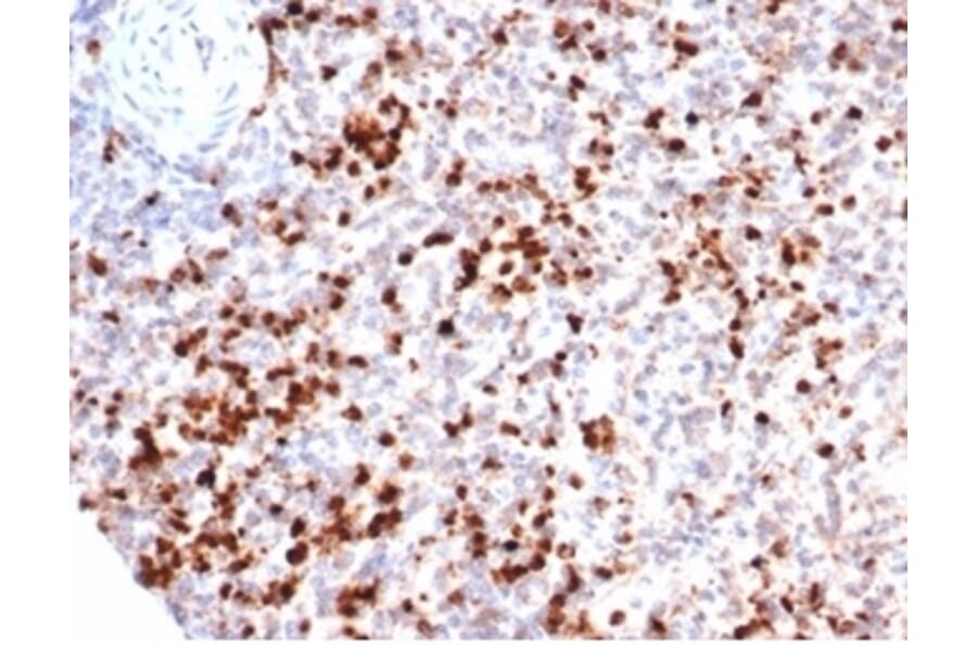 Immunohistochemistry - Anti-Myeloperoxidase Antibody [rMPO/6904] (A277902) - Antibodies.com