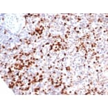 Immunohistochemistry - Anti-Myeloperoxidase Antibody [rMPO/6904] (A277902) - Antibodies.com