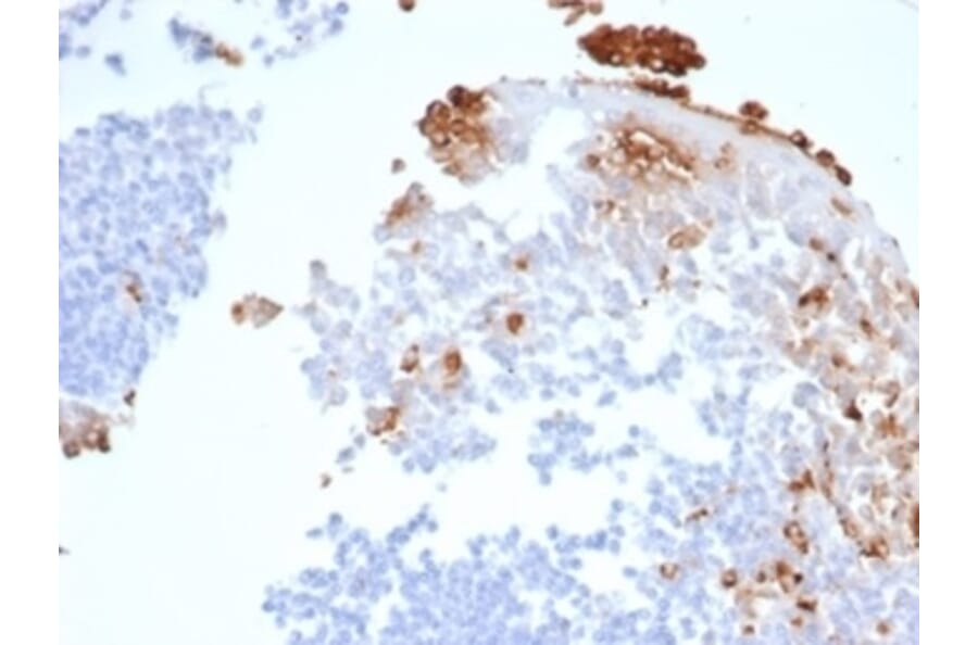 Immunohistochemistry - Anti-Myeloperoxidase Antibody [rMPO/6904] (A277902) - Antibodies.com