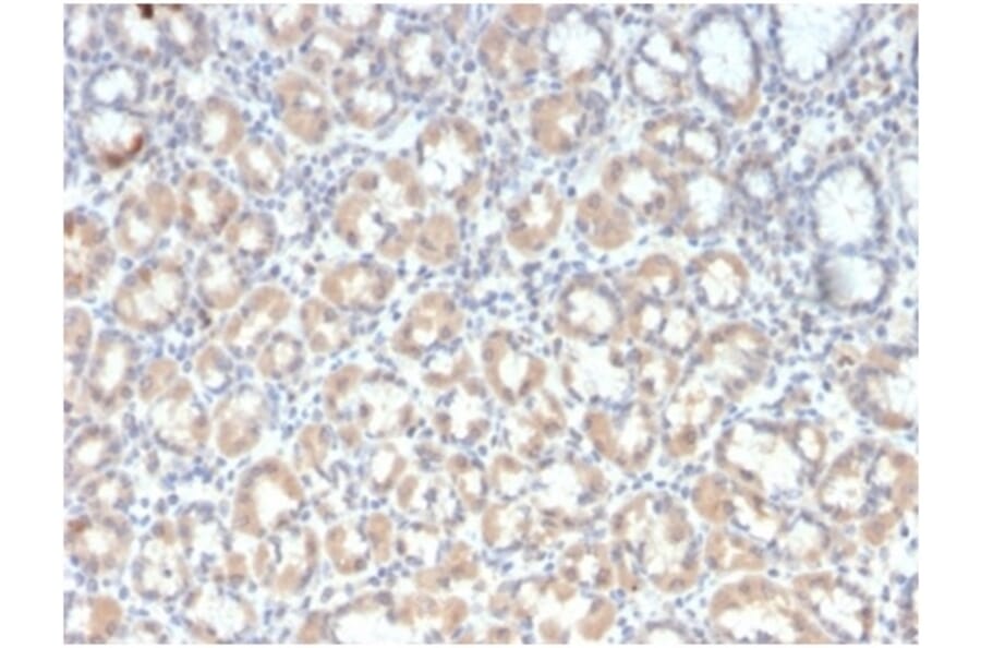 Immunohistochemistry - Anti-MUC3 Antibody [rMUC3/1154] (A277903) - Antibodies.com