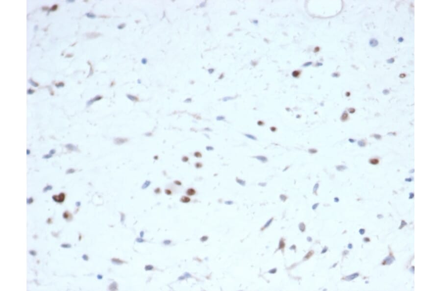 Immunohistochemistry - Anti-MyoD1 Antibody [rMYOD1/6911] (A277904) - Antibodies.com