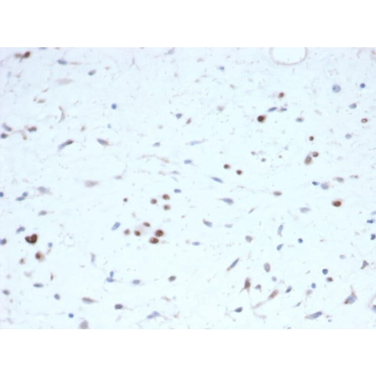 Immunohistochemistry - Anti-MyoD1 Antibody [rMYOD1/6911] (A277904) - Antibodies.com