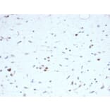 Immunohistochemistry - Anti-MyoD1 Antibody [rMYOD1/6911] (A277904) - Antibodies.com