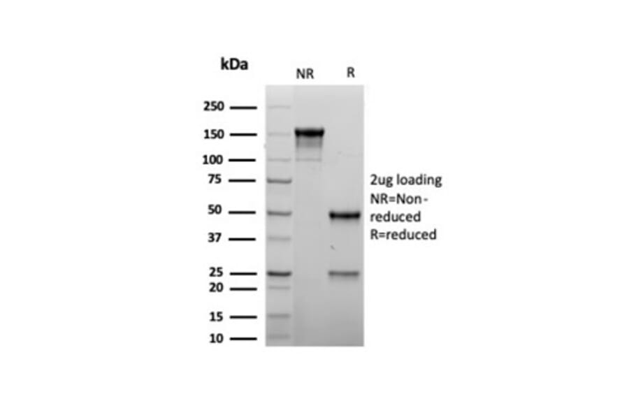 SDS-PAGE - Anti-MyoD1 Antibody [rMYOD1/6911] (A277904) - Antibodies.com
