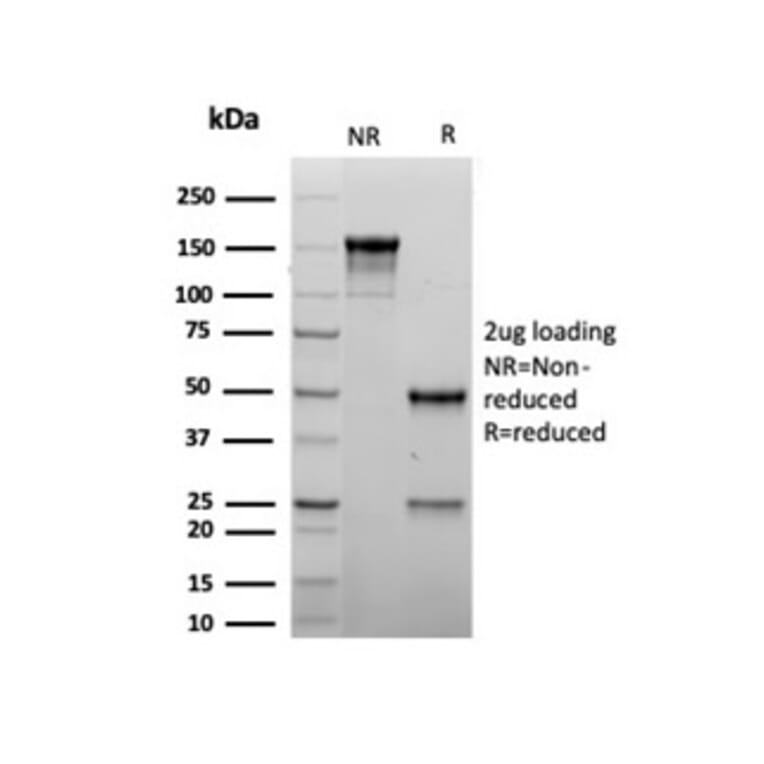 SDS-PAGE - Anti-MyoD1 Antibody [rMYOD1/6911] (A277904) - Antibodies.com