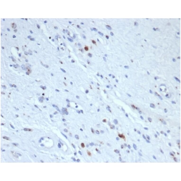 Immunohistochemistry - Anti-Myogenin Antibody [rMYOG/6297] (A277905) - Antibodies.com