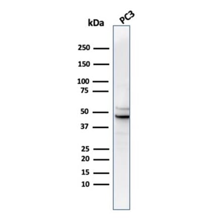 Western Blot - Anti-Ornithine Decarboxylase Antibody [rODC1/487] (A277906) - Antibodies.com