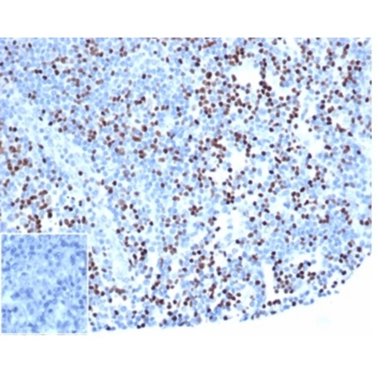 Immunohistochemistry - Anti-LEF1 Antibody [rLEF1/6906] (A277907) - Antibodies.com