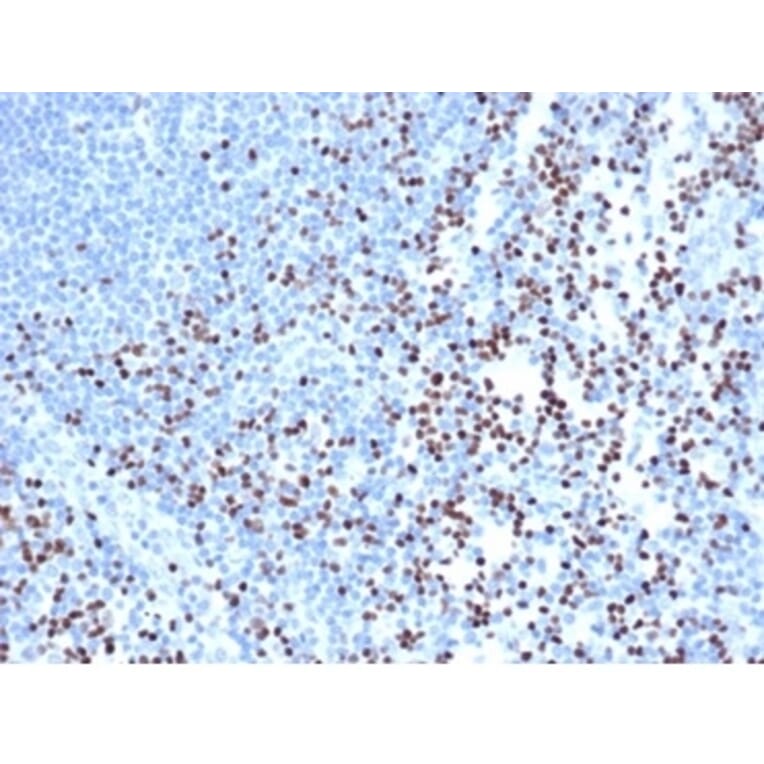 Immunohistochemistry - Anti-LEF1 Antibody [rLEF1/6906] (A277907) - Antibodies.com