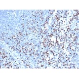 Immunohistochemistry - Anti-LEF1 Antibody [rLEF1/6906] (A277907) - Antibodies.com