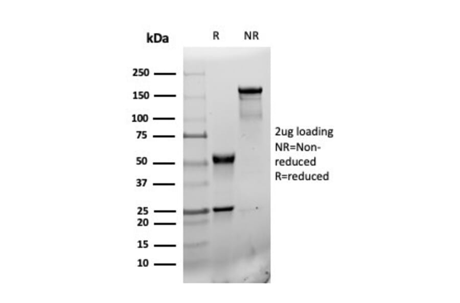 SDS-PAGE - Anti-CD31 Antibody [r6439] (A277908) - Antibodies.com