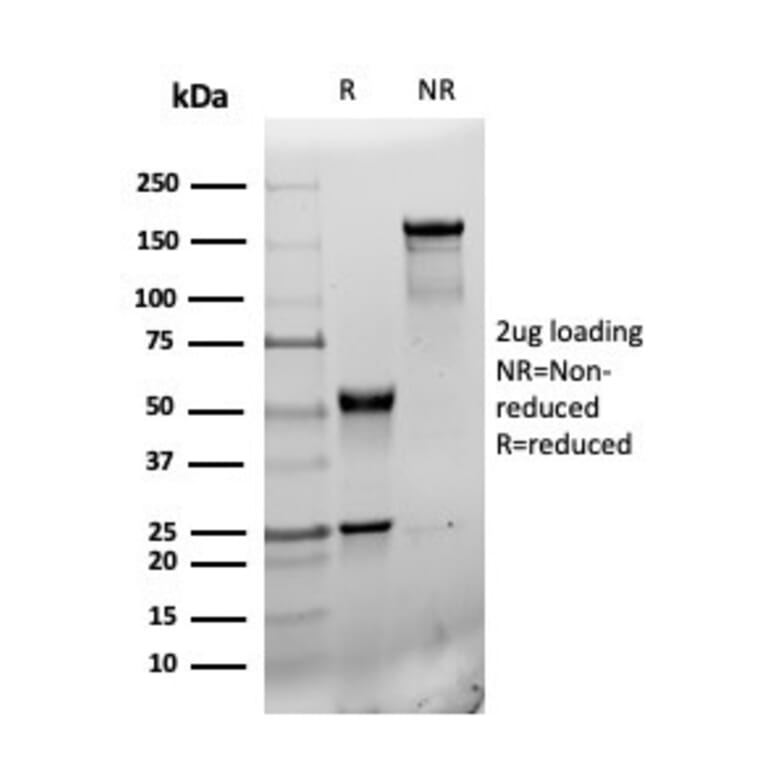 SDS-PAGE - Anti-CD31 Antibody [r6439] (A277908) - Antibodies.com