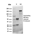 SDS-PAGE - Anti-CD31 Antibody [r6439] (A277908) - Antibodies.com