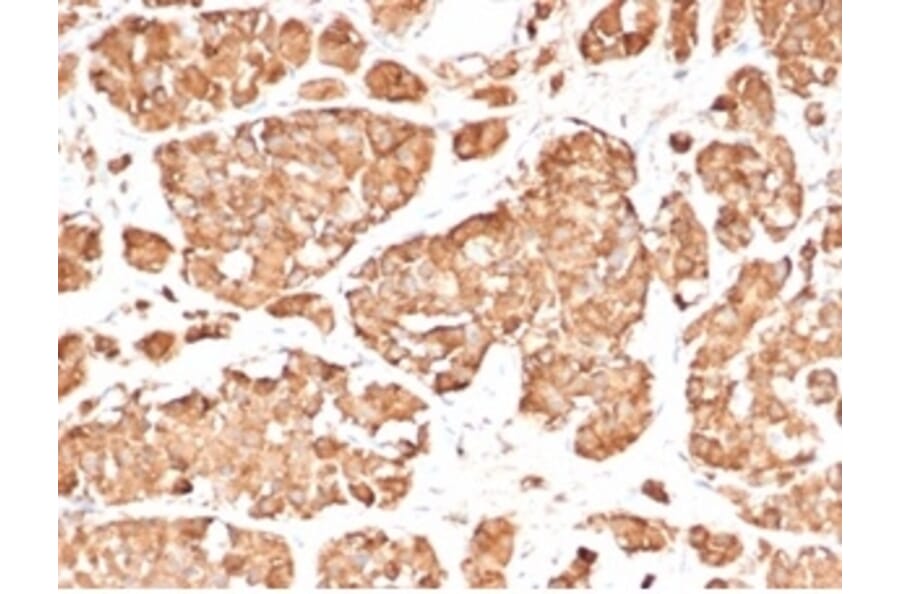 Immunohistochemistry - Anti-ACTH Antibody [rCLIP/3814] (A277909) - Antibodies.com