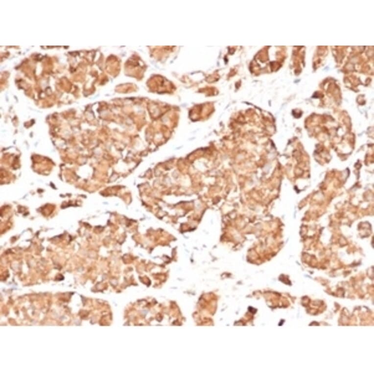 Immunohistochemistry - Anti-ACTH Antibody [rCLIP/3814] (A277909) - Antibodies.com