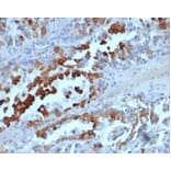 Immunohistochemistry - Anti-Cytokeratin 20 Antibody [rKRT20/6536] (A277911) - Antibodies.com