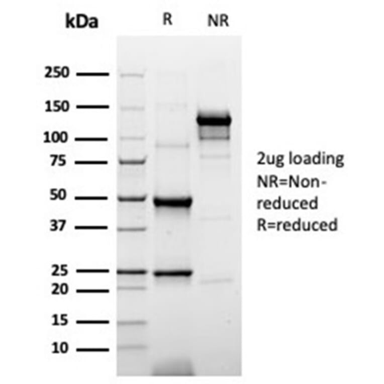 SDS-PAGE - Anti-Cytokeratin 20 Antibody [rKRT20/6536] (A277911) - Antibodies.com