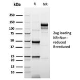 SDS-PAGE - Anti-Cytokeratin 20 Antibody [rKRT20/6536] (A277911) - Antibodies.com