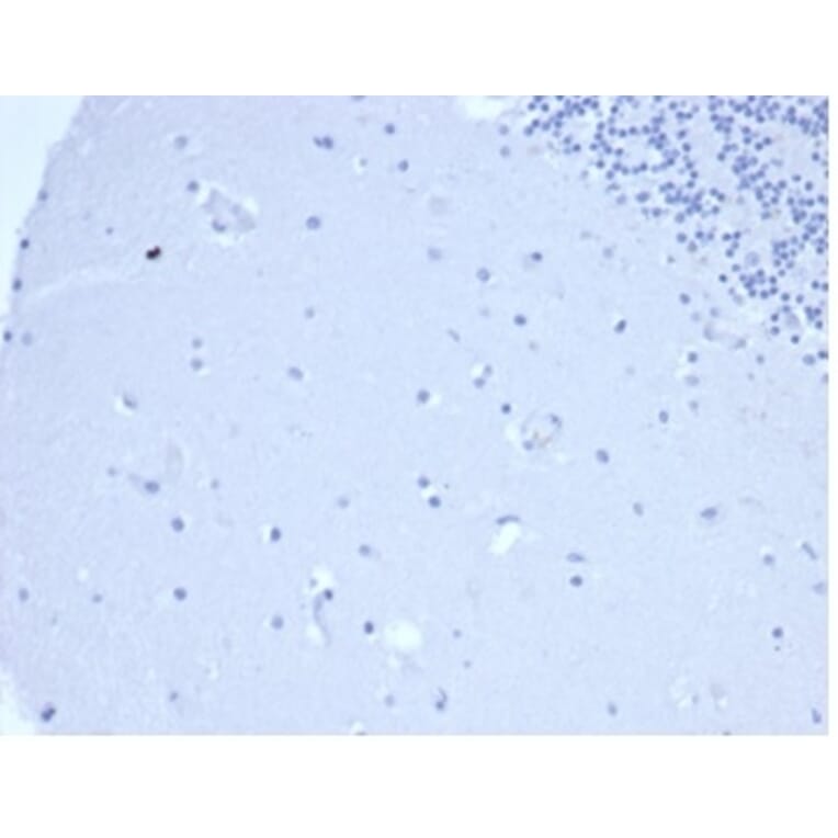 Immunohistochemistry - Anti-Prolactin Antibody [rPRL/4907] (A277912) - Antibodies.com