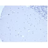 Immunohistochemistry - Anti-Prolactin Antibody [rPRL/4907] (A277912) - Antibodies.com