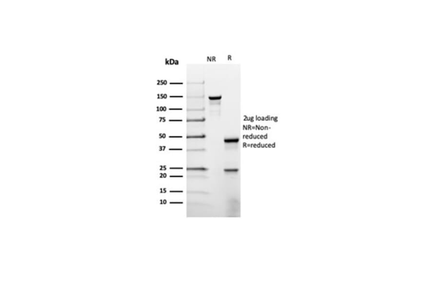 SDS-PAGE - Anti-Prolactin Antibody [rPRL/4907] (A277912) - Antibodies.com