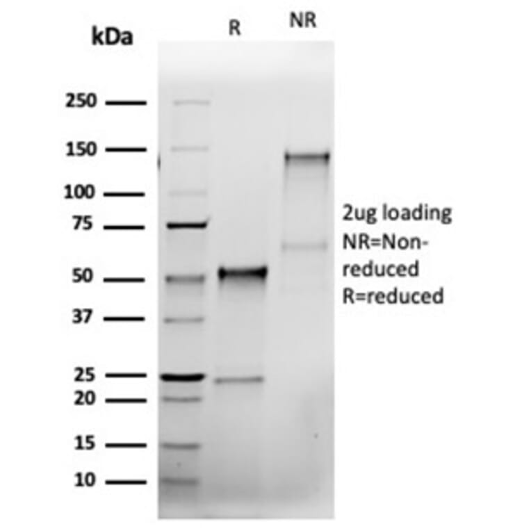 SDS-PAGE - Anti-Bcl-X Antibody [rBCL2L1/4508] (A277914) - Antibodies.com