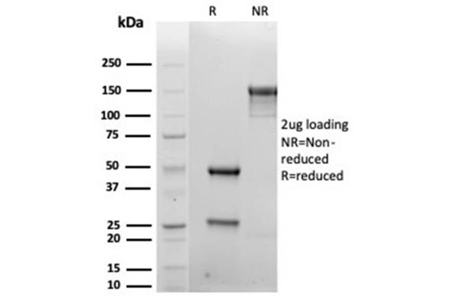 SDS-PAGE - Anti-Syndecan 1 Antibody [rSDC1/6866] (A277915) - Antibodies.com