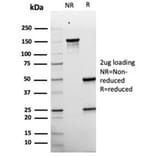 SDS-PAGE - Anti-Melanoma gp100 Antibody [rPMEL17/6821] (A277918) - Antibodies.com