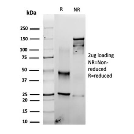 SDS-PAGE - Anti-Fascin Antibody [rFSCN1/6464] (A277919) - Antibodies.com