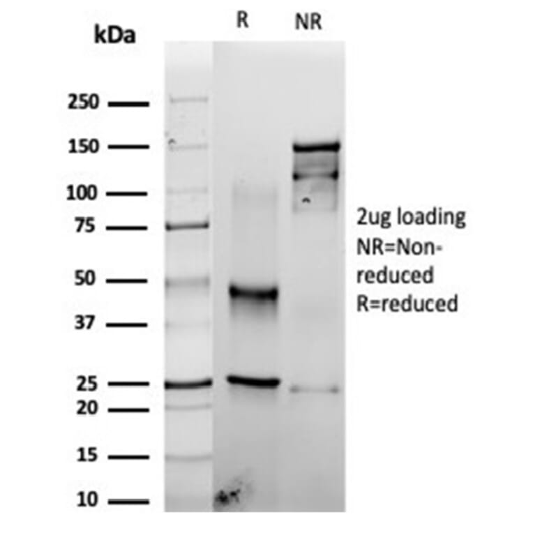 SDS-PAGE - Anti-Fascin Antibody [rFSCN1/6464] (A277919) - Antibodies.com