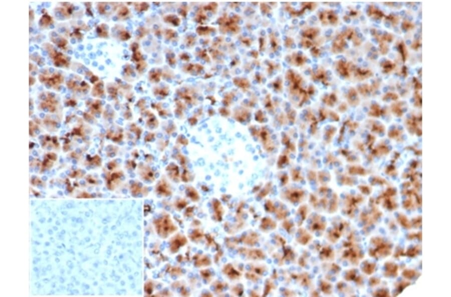 Immunohistochemistry - Anti-Fascin Antibody [rFSCN1/6464] (A277919) - Antibodies.com