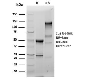 SDS-PAGE - Anti-Fascin Antibody [FSCN1/6465R] (A277920) - Antibodies.com