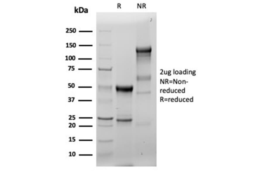 SDS-PAGE - Anti-Fascin Antibody [FSCN1/6465R] (A277920) - Antibodies.com