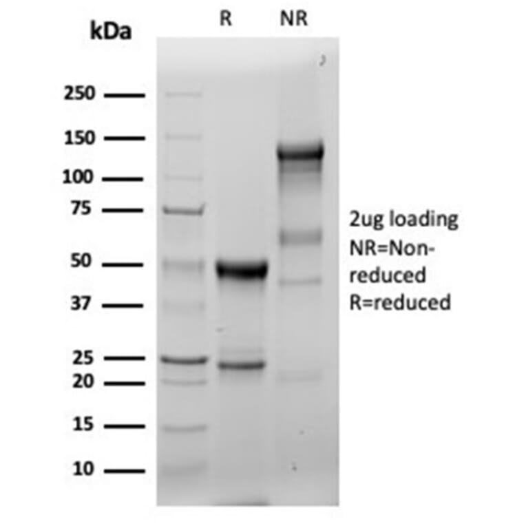 SDS-PAGE - Anti-Fascin Antibody [FSCN1/6465R] (A277920) - Antibodies.com