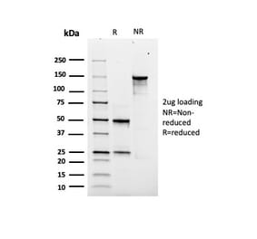 SDS-PAGE - Anti-SOX9 Antibody [rSOX9/2288] (A277921) - Antibodies.com