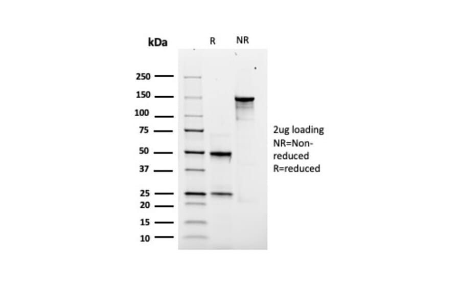 SDS-PAGE - Anti-SOX9 Antibody [rSOX9/2288] (A277921) - Antibodies.com