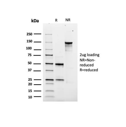 SDS-PAGE - Anti-SOX9 Antibody [rSOX9/2288] (A277921) - Antibodies.com
