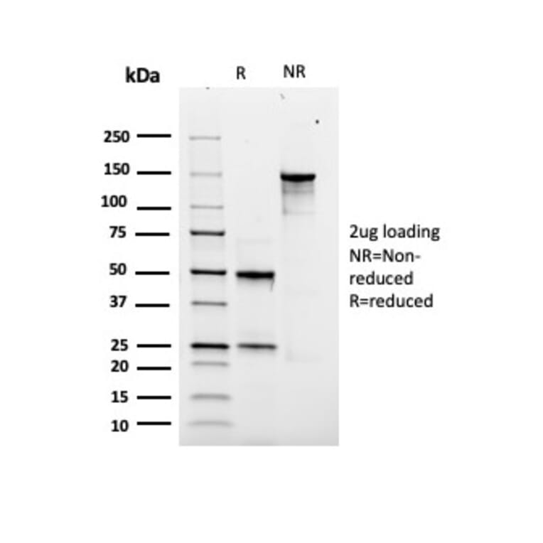 SDS-PAGE - Anti-SOX9 Antibody [rSOX9/2288] (A277921) - Antibodies.com