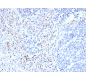 Immunohistochemistry - Anti-PU.1 Antibody [rPU1/2146] (A277922) - Antibodies.com