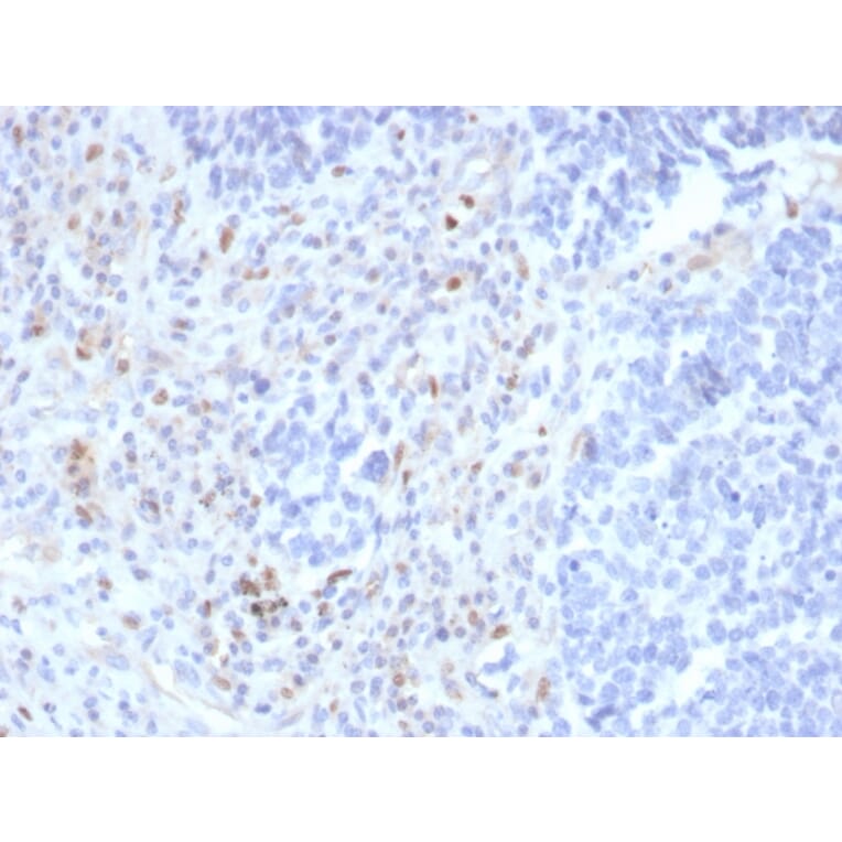 Immunohistochemistry - Anti-PU.1 Antibody [rPU1/2146] (A277922) - Antibodies.com