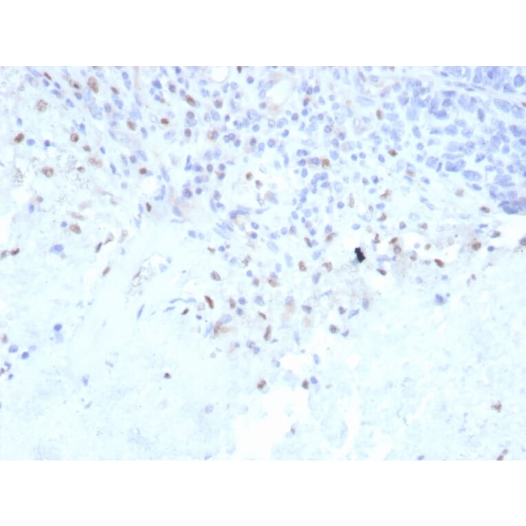Immunohistochemistry - Anti-PU.1 Antibody [rPU1/2146] (A277922) - Antibodies.com